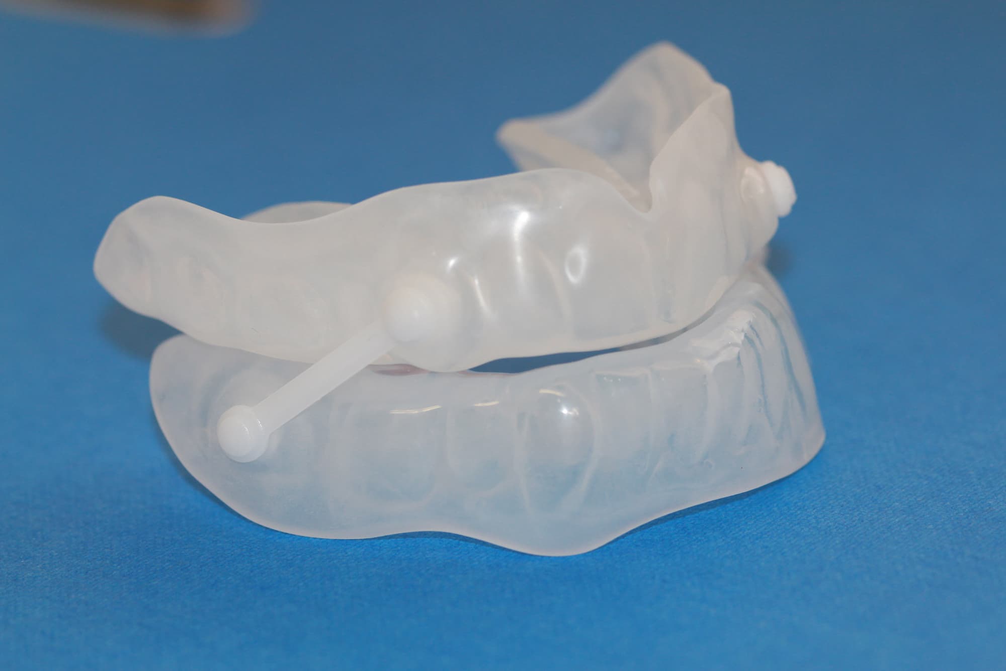 Custom snoring appliance